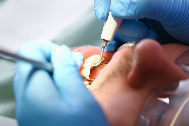 Best Emergency Dental Surgery in New Castle, IN
